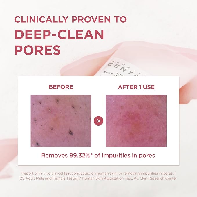 SKIN1004 Centella Cleansing Foam soothing benefits