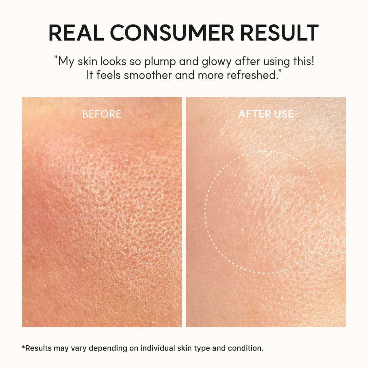 Arencia NAD+ Booster Shot how to use on face and eyes