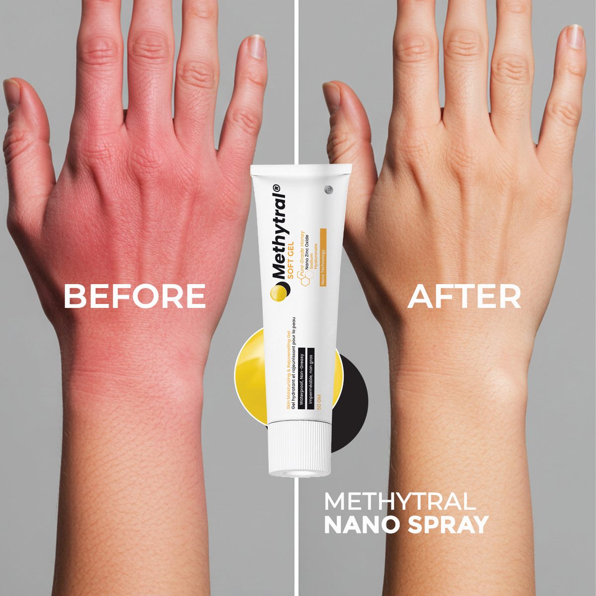 Methytral Soft Gel soothing gel texture