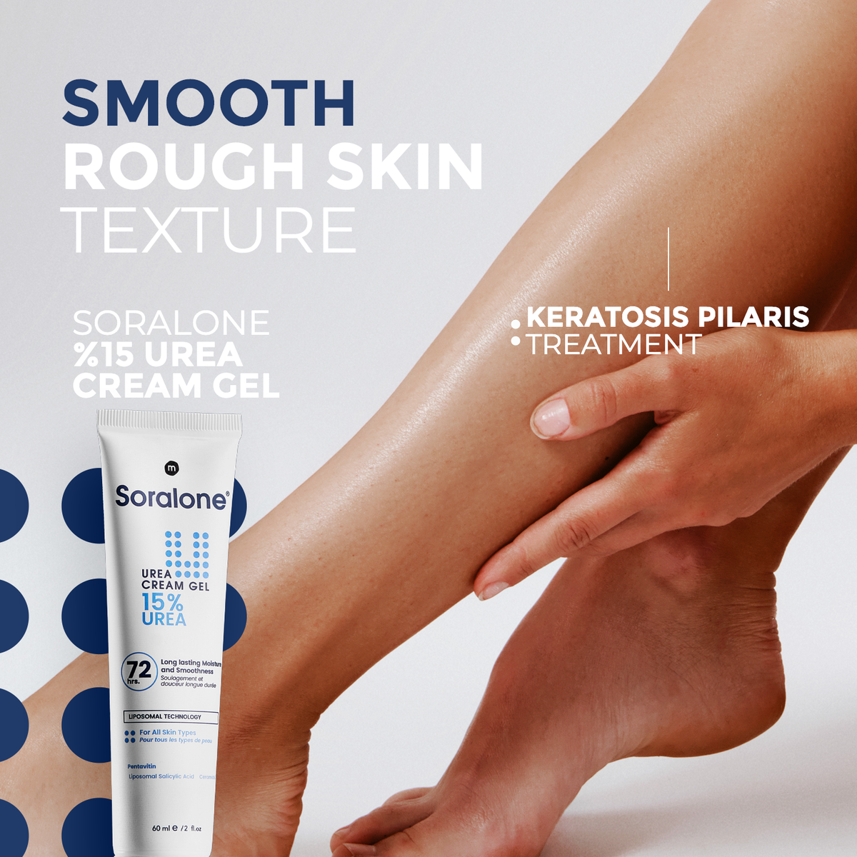 Soralone Urea 15% Cream Gel 60ml tube and box